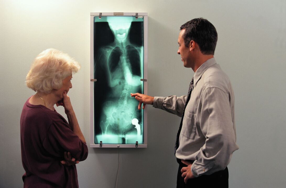 X-ray diagnosis for pain in the hip joint