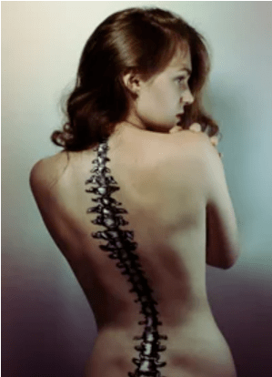 Osteochondrosis of the cause