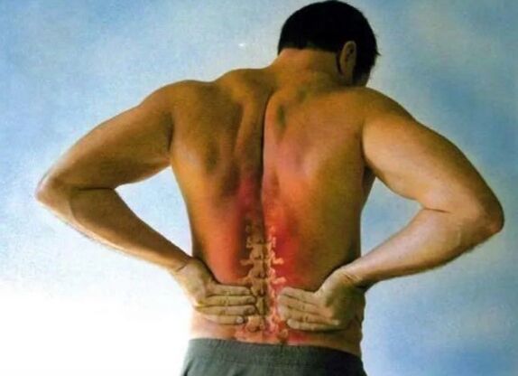 Lumbar osteochondrosis pain
